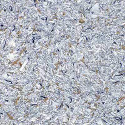 Текстура жидкие обои, штукатурка Texture Liquid Wallpaper, plaster Oboi0025